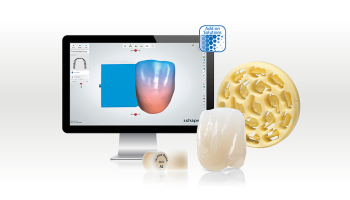 Técnica analógica y CAD_CAM en la técnica dental_ combine el trabajo manual clásico con pasos de trabajo digitales